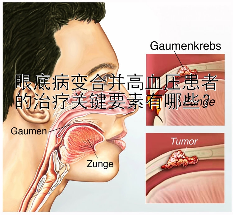 眼底病变合并高血压患者的治疗关键要素有哪些？