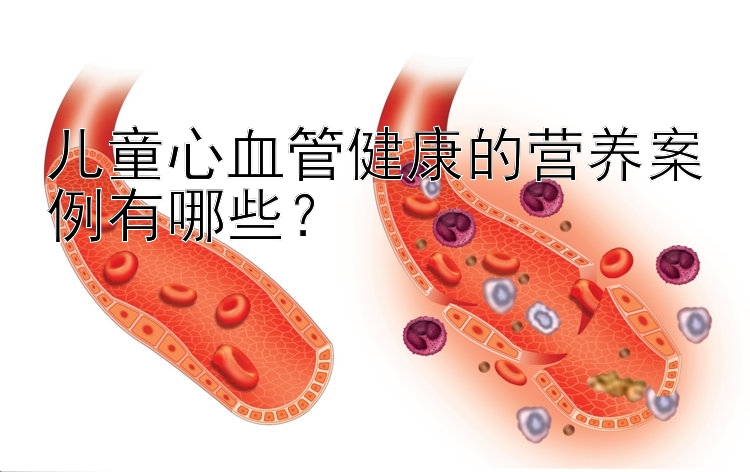 儿童心血管健康的营养案例有哪些？