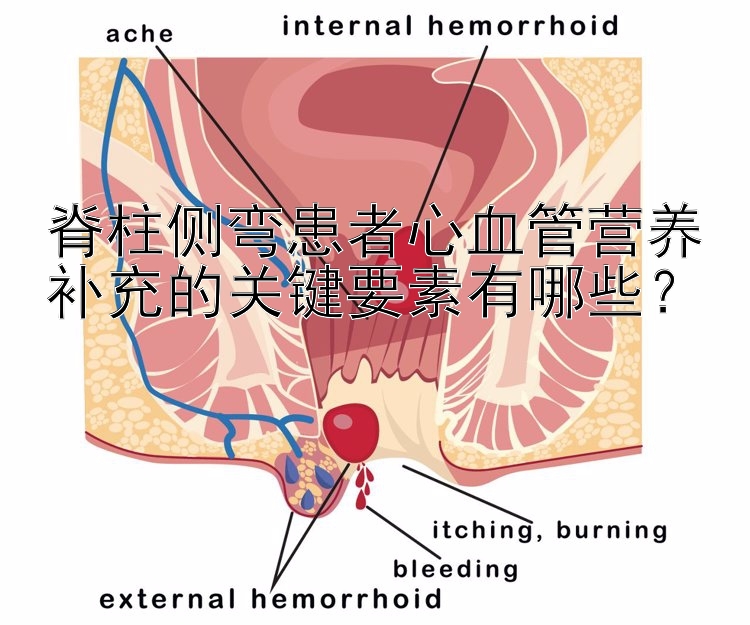 脊柱侧弯患者心血管营养补充的关键要素有哪些？