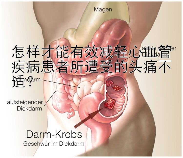 怎样才能有效减轻心血管疾病患者所遭受的头痛不适？